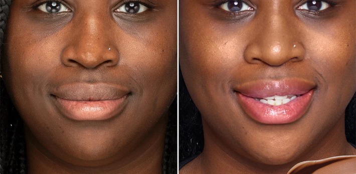 Without and with Mineral Sun Glow, Tan-Deep